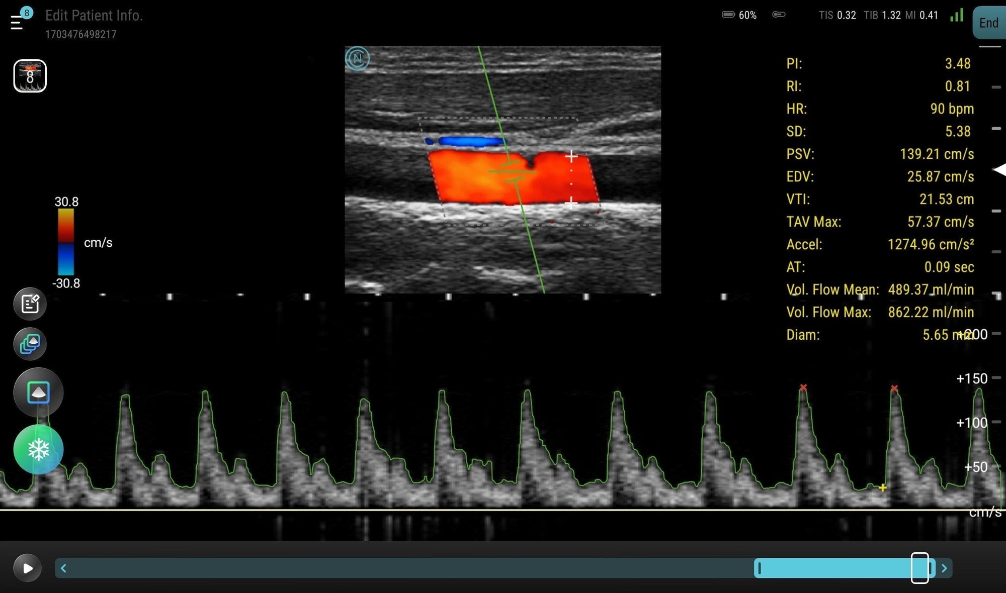 Advanced Doppler Techniques: When and How to Use Power, Color, and Spe ...